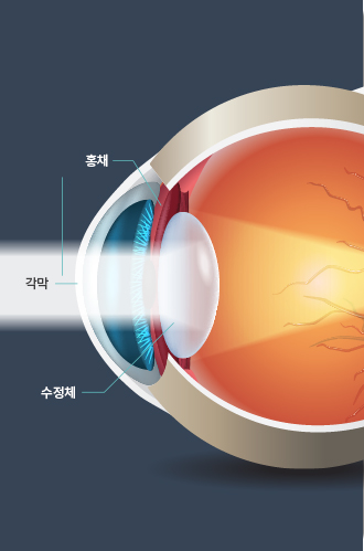 노안