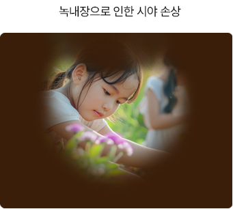 백내장의 증상